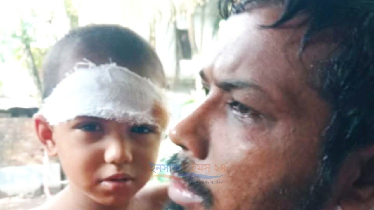 কাঠালিয়ায় বেপরোয়া মোটরসাইকেলের ধাক্কায় আহত ৫ বছরের শিশু, চালককে আটক করে জনতা