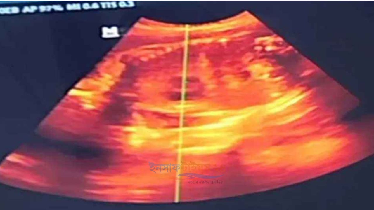 ৬ মাসের অন্তঃসত্ত্বা প্রতিবন্ধী নারী, অনাগত সন্তানের পিতৃত্ব নিয়ে ধোঁয়াশা
